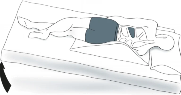 Posturale Drainage: Natürliche Unterstützung für die Lungenfunktion