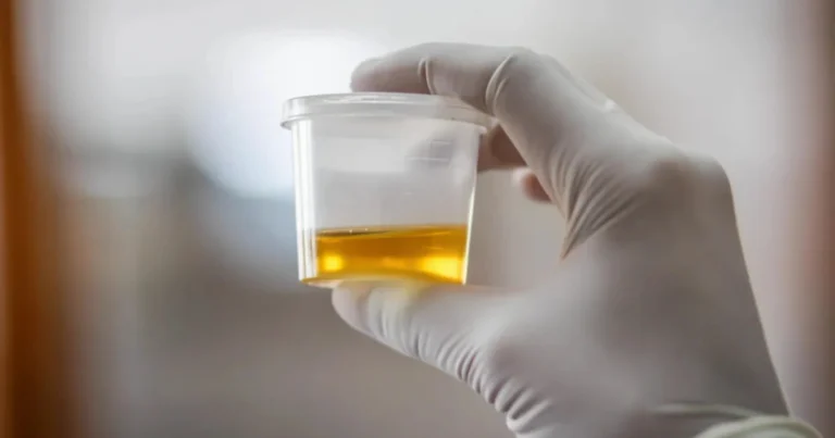 Die Urinfarbe richtig deuten: Was sie über Hydration und Gesundheit verrät